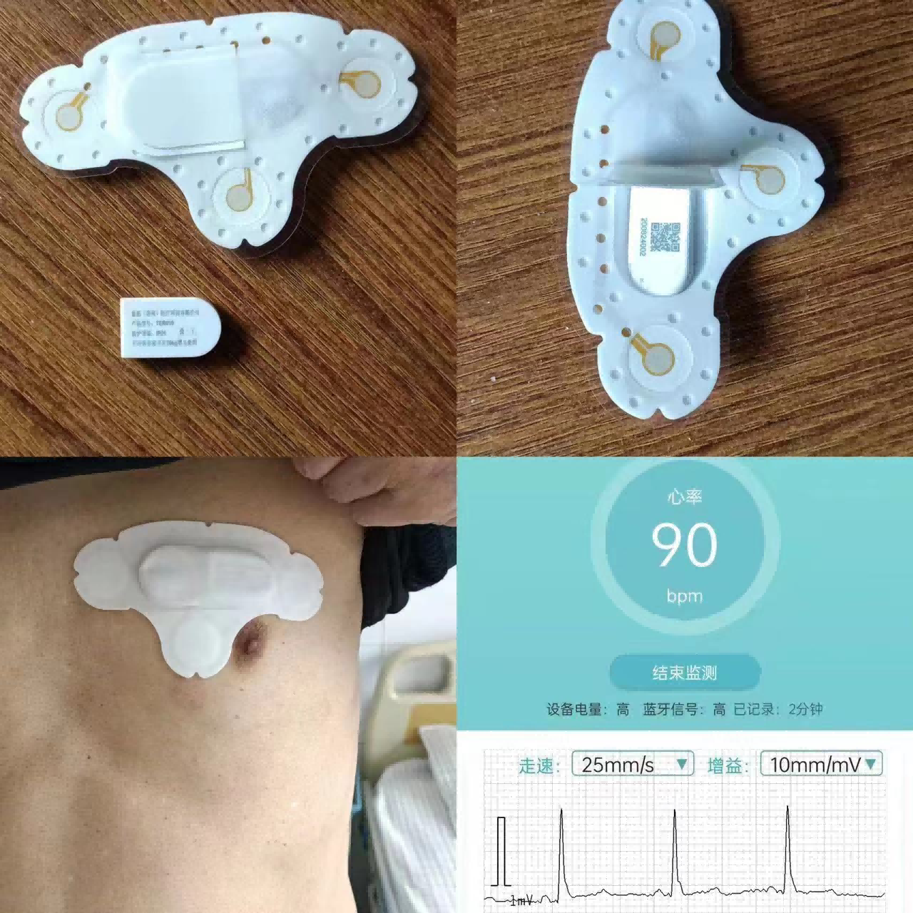 72小时动态心电图(1)